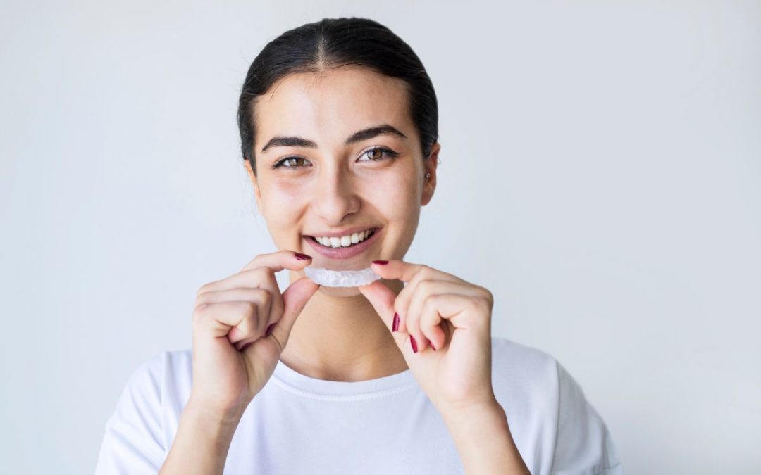 3 Reasons We Love Aligners